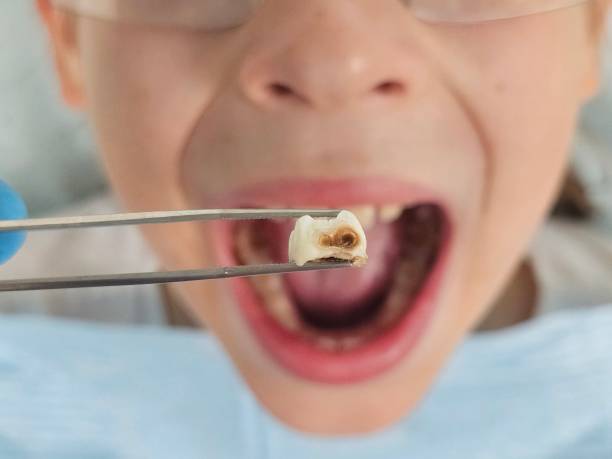 Best Emergency Pediatric Dentist  in Union Park, FL